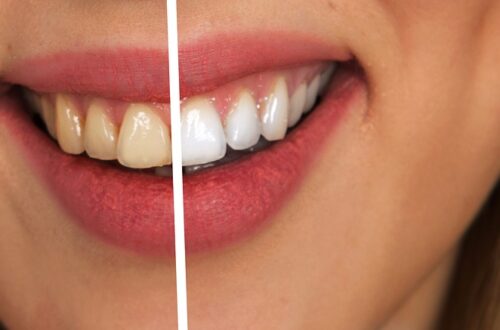 teeth, dental care, white-2414909.jpg