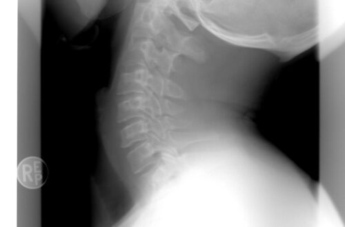 xray, cervical spine, healthcare-1129436.jpg
